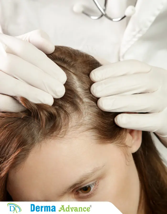 A dermatologist examining a person's scalp to help prevent Scalp Psoriasis.