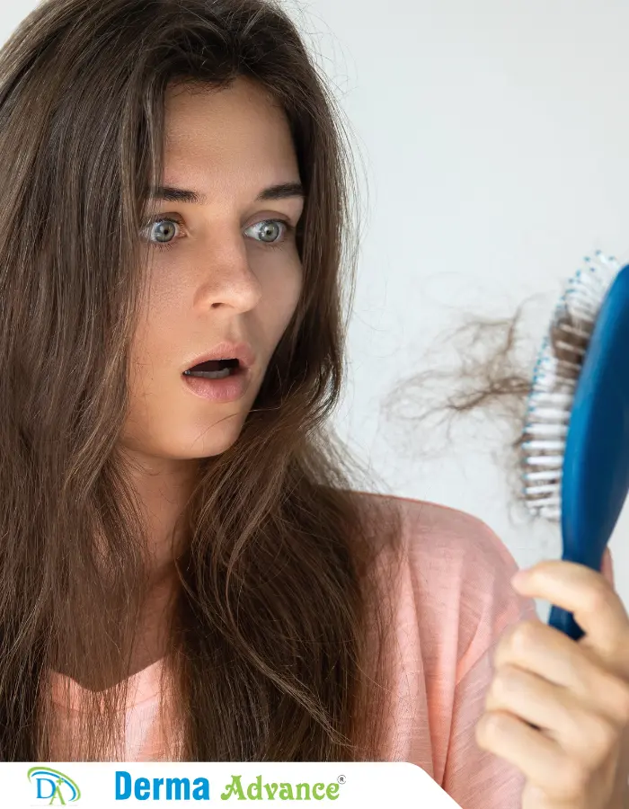 A girl suffering with telogen effluvium, she is looking at her hairbrush which is full of her hair.