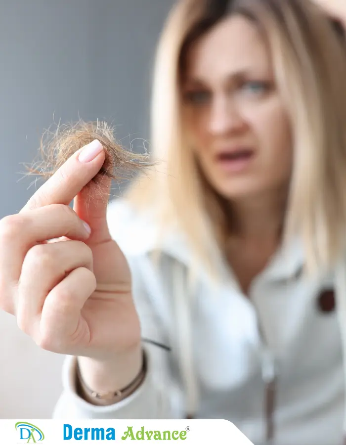 A girl suffering with trichotillomania and she is showing the hair which she pulled out from her scalp.