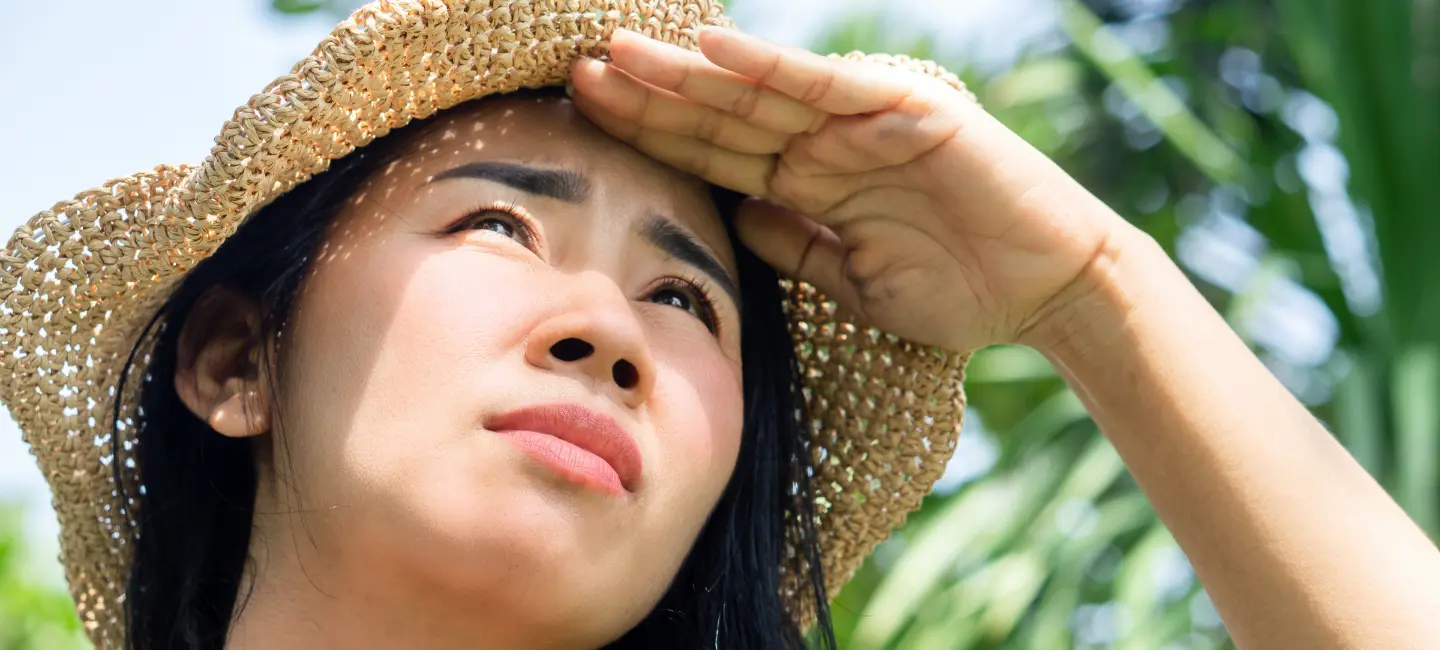 A girl wearing a hat in direct sunlight prone to getting her skin sun-damaged.