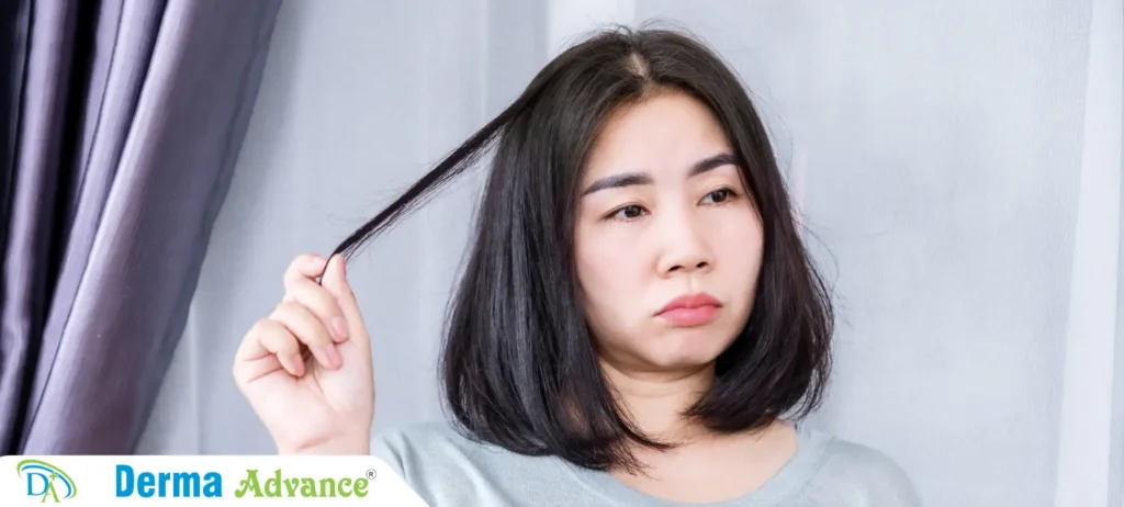 A girl suffering with trichotillomania hair-pulling behavior and its impacting her scalp and hair health.