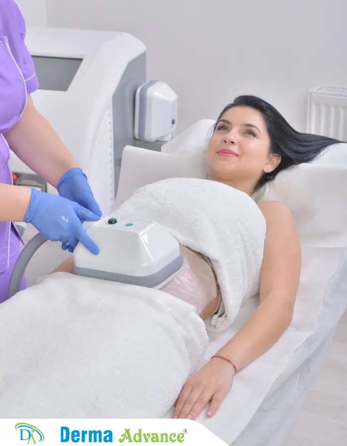 A close-up image of a Cryolipolysis device applied to a patient's abdomen, illustrating the process of fat freezing for body contouring.