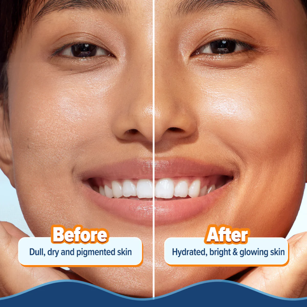 Comparison of skin before and after hydration, showing improved glow and smoothness.






