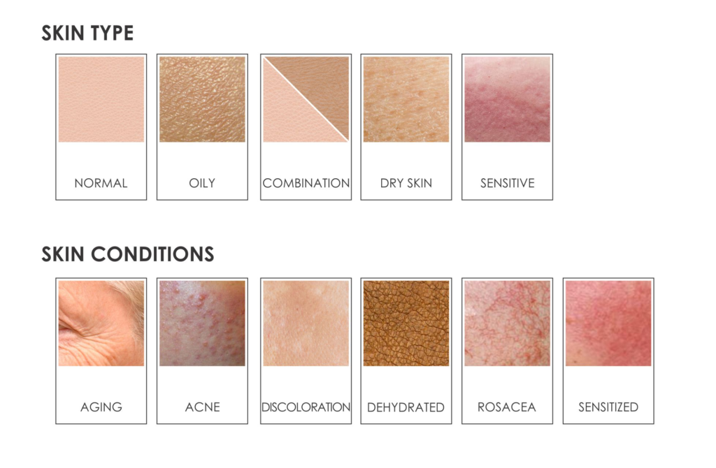 Illustration showing various skin types (e.g., oily, dry, combination, sensitive) and common skin conditions (e.g., acne, rosacea, eczema) with corresponding visual examples.