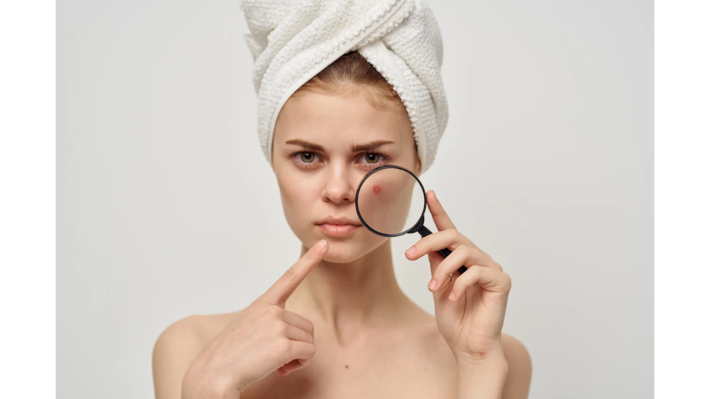 A young girl pointing to a pimple on her face caused by common skincare mistakes, highlighting the impact of improper skincare routines.






