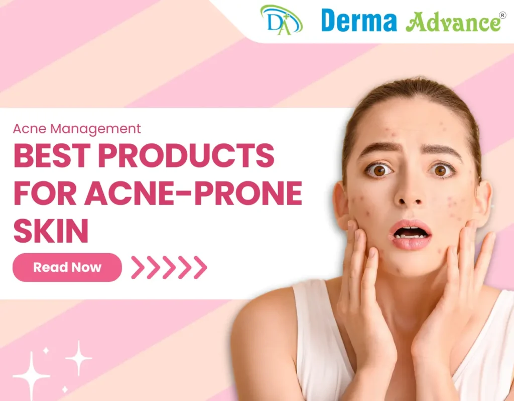 Featured Image of the blog titled Best Products for Acne-Prone Skin.