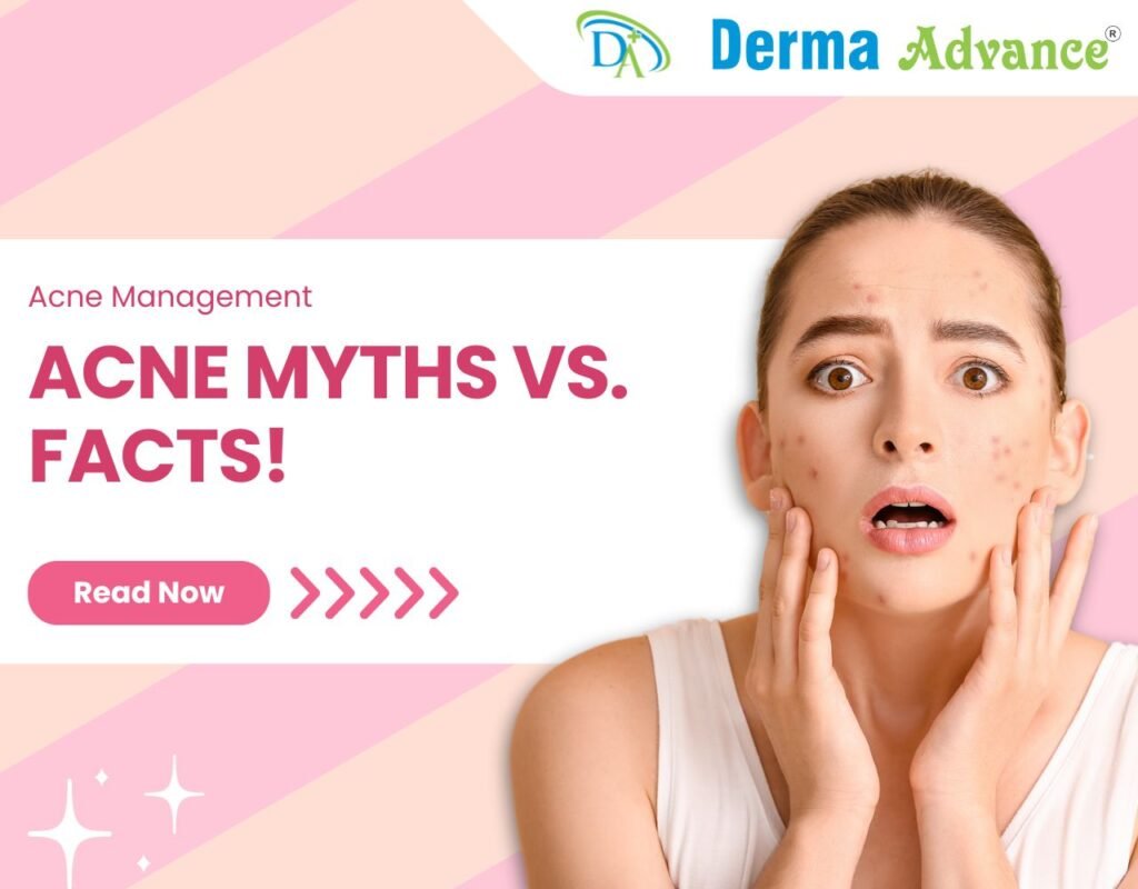 Featured image of Acne Myths VS Facts