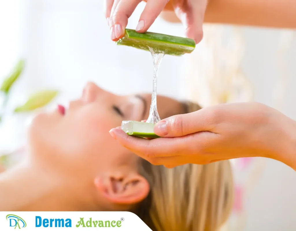 Image pf a lady applying Aloe Vera to avoid redness of Pimples.