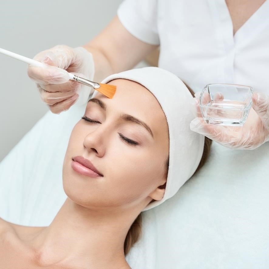 Image of a chemical peel treatment, with a clinician applying a chemical solution to a patient's face to exfoliate the skin and reduce the appearance of open pores."