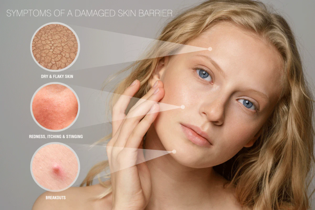 Illustration showing symptoms of a damaged skin barrier, including dryness, redness, irritation, flakiness, increased sensitivity, and breakouts.