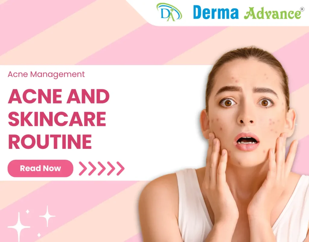 Featured image of Acne and Skincare Routine.