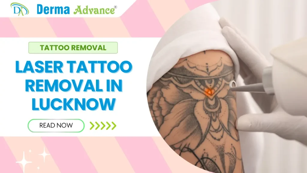 Tattoo Removal in Lucknow – Professional Laser Treatment for Effective Results