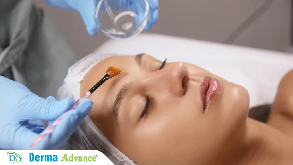 Different types of chemical peels for skin treatment