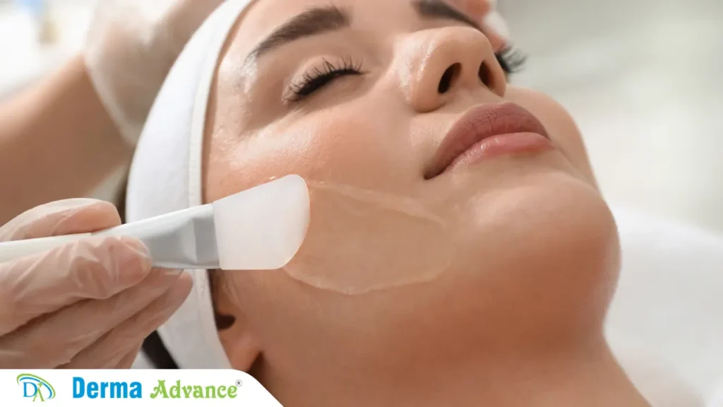 Chemical peel treatment process for skin rejuvenation