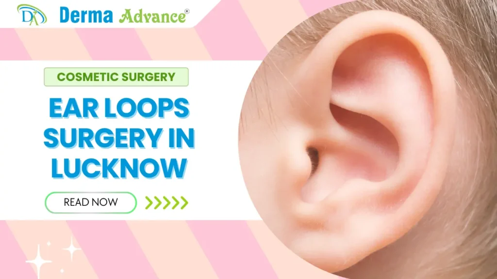 Ear Loops Surgery at Derma Advance in Lucknow