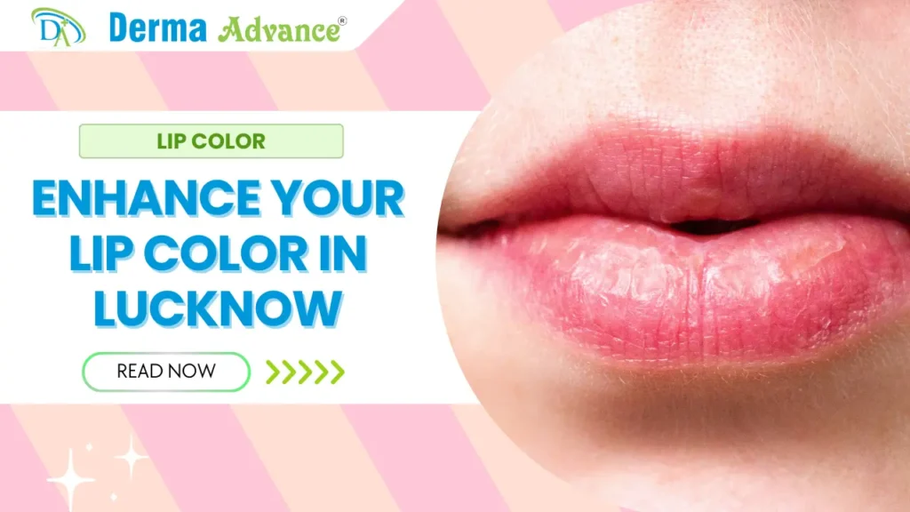 Lip color enhancement treatment at Derma Advance in Lucknow