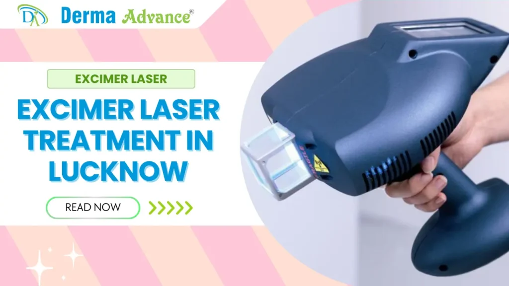 Excimer Laser Treatment in Lucknow at Derma Advance Clinic for advanced skin care.