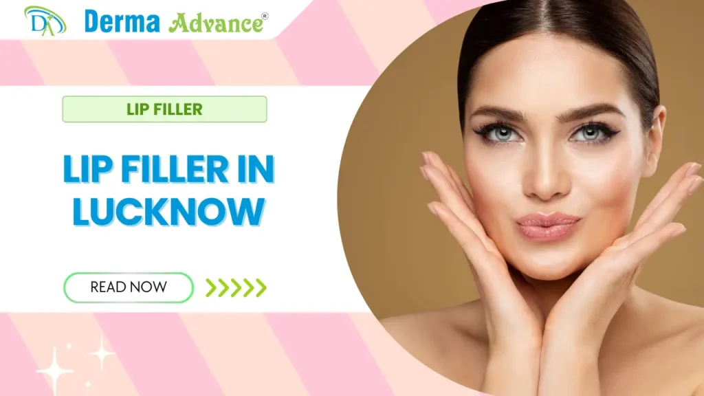 Lip Filler treatment at Derma Advance in Lucknow