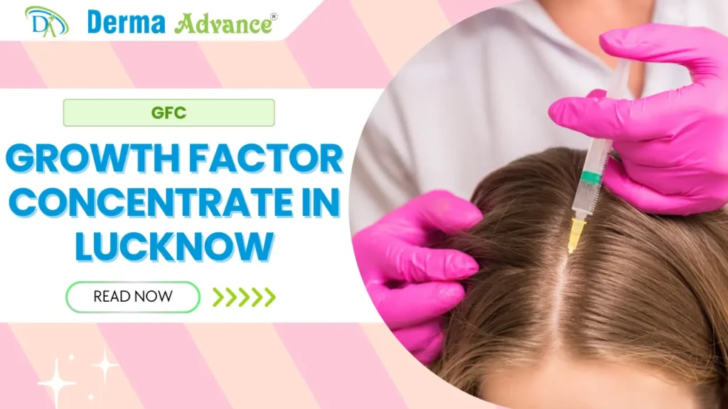 Growth Factor Concentrate treatment at Derma Advance in Lucknow